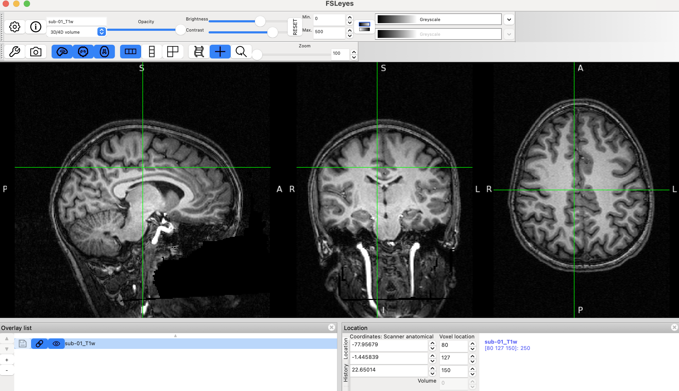 anat_change_contrast