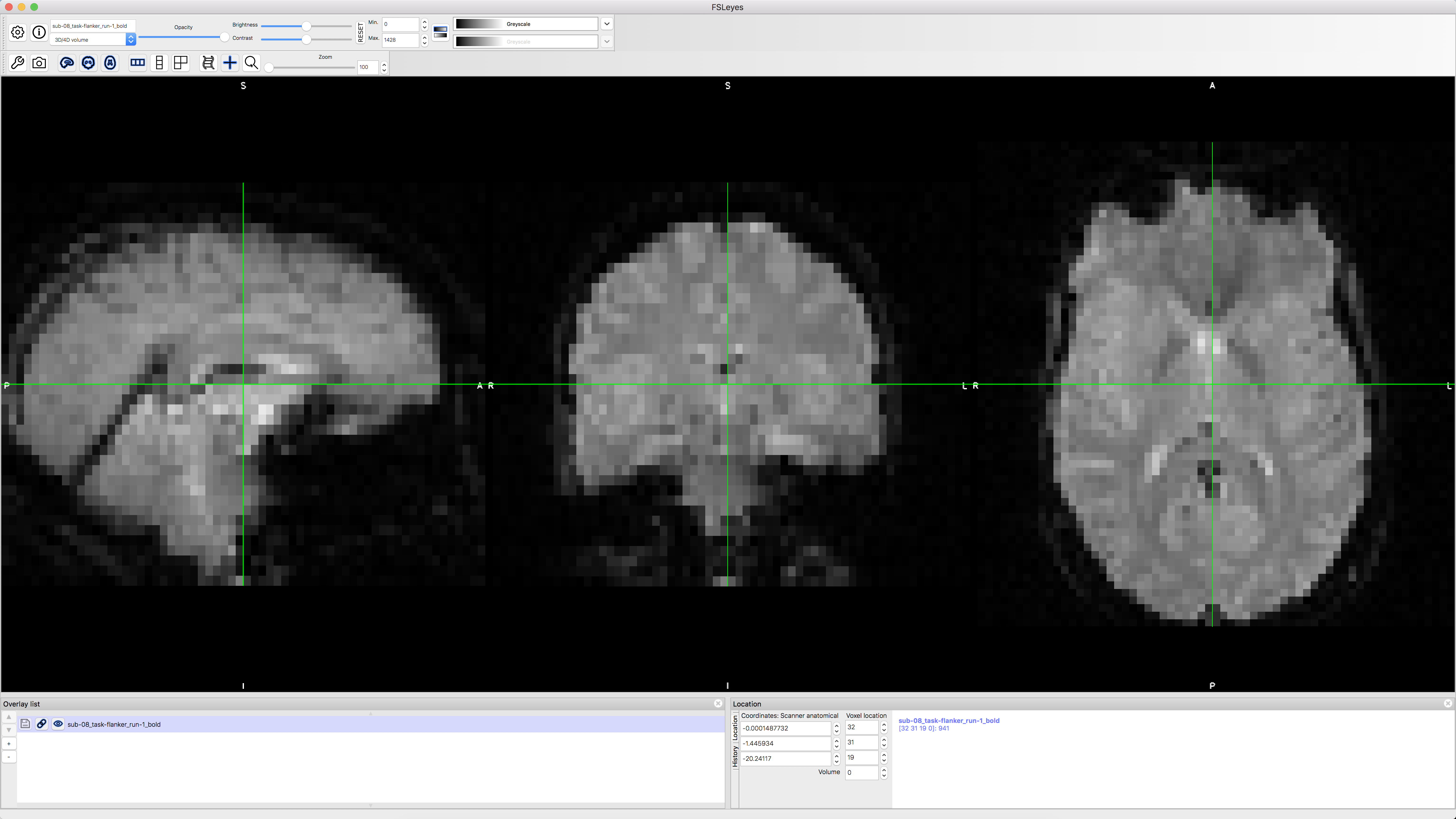 functional_firstlook