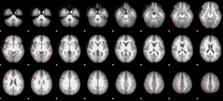 3rdLevelAnalysis_FEAT_Output