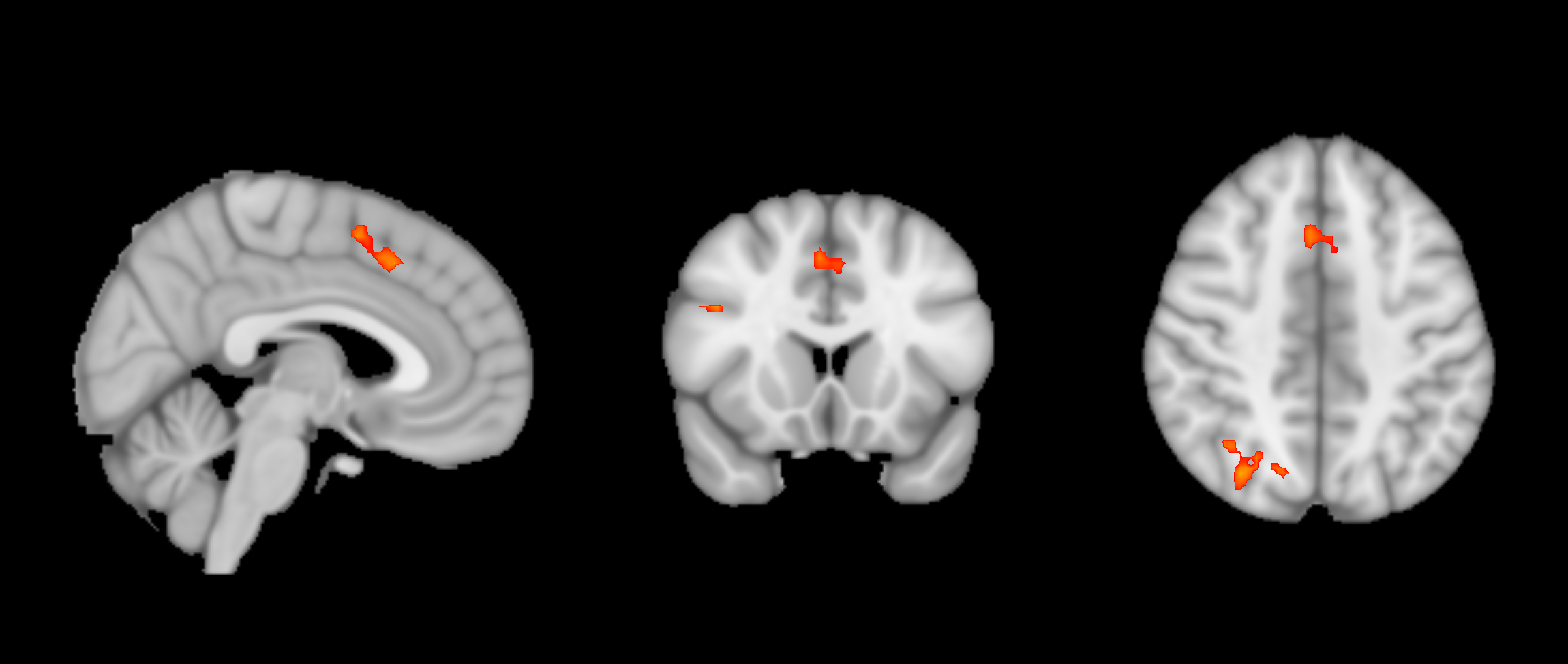 3rdLevelAnalysis_ThresholdedStatsMontage