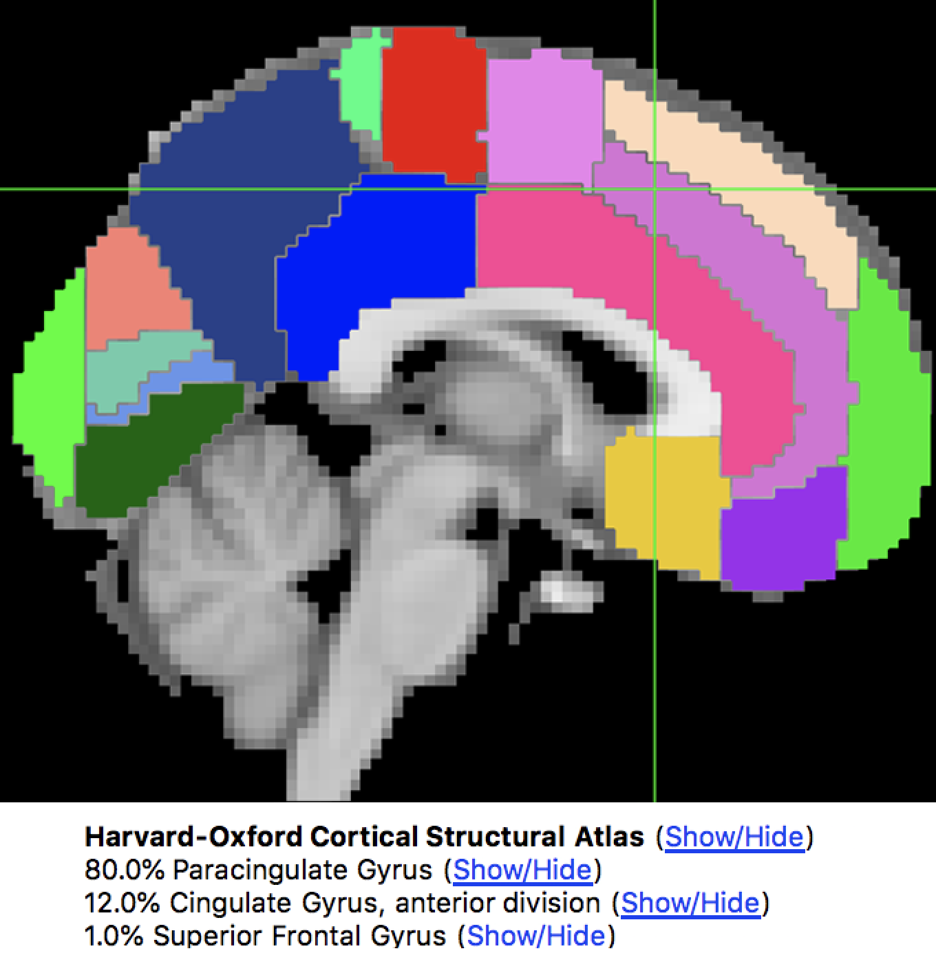 ROI_Analysis_Atlas_Example