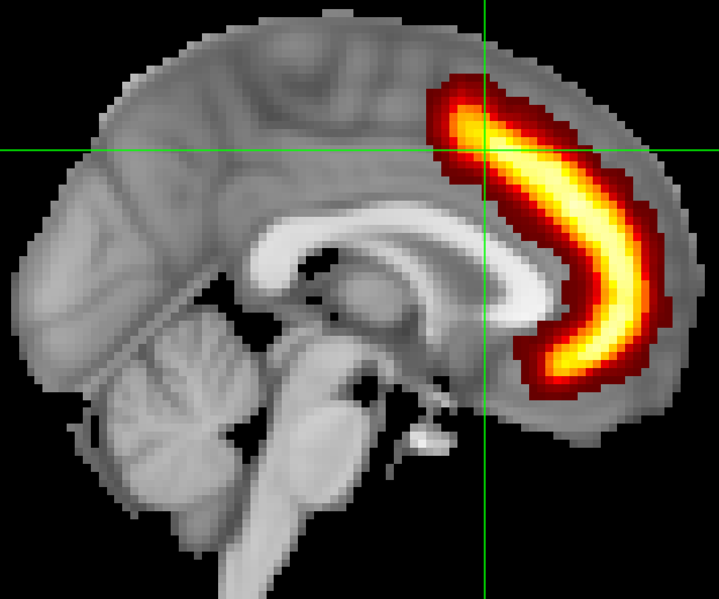 ROI_Analysis_PCG_Mask