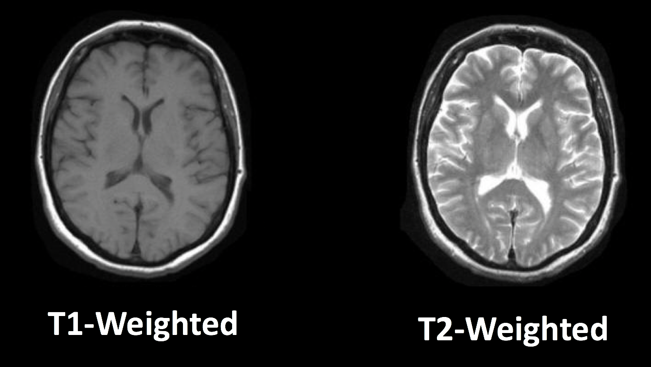 spine-mri-dubai-dr