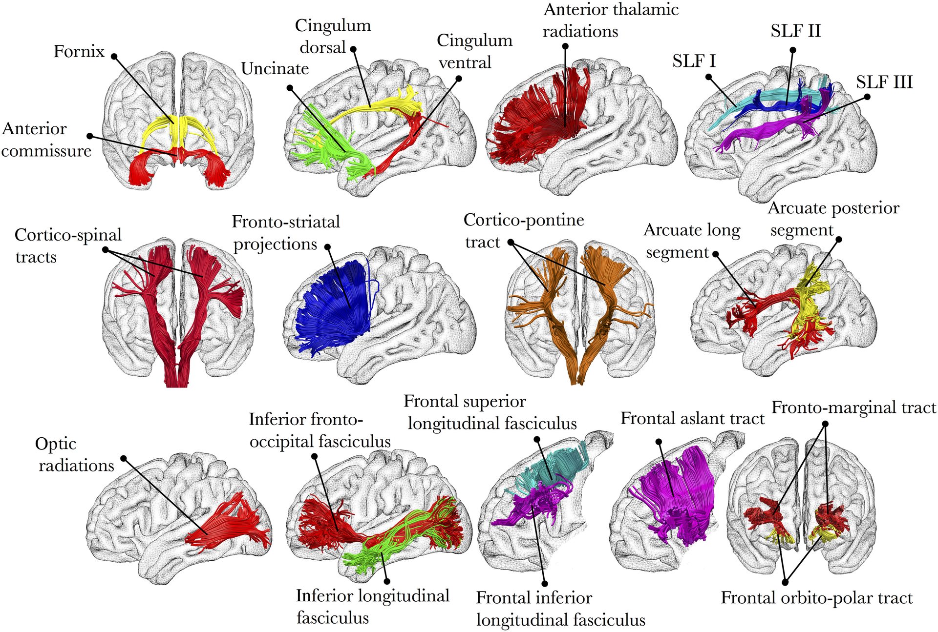 white matter